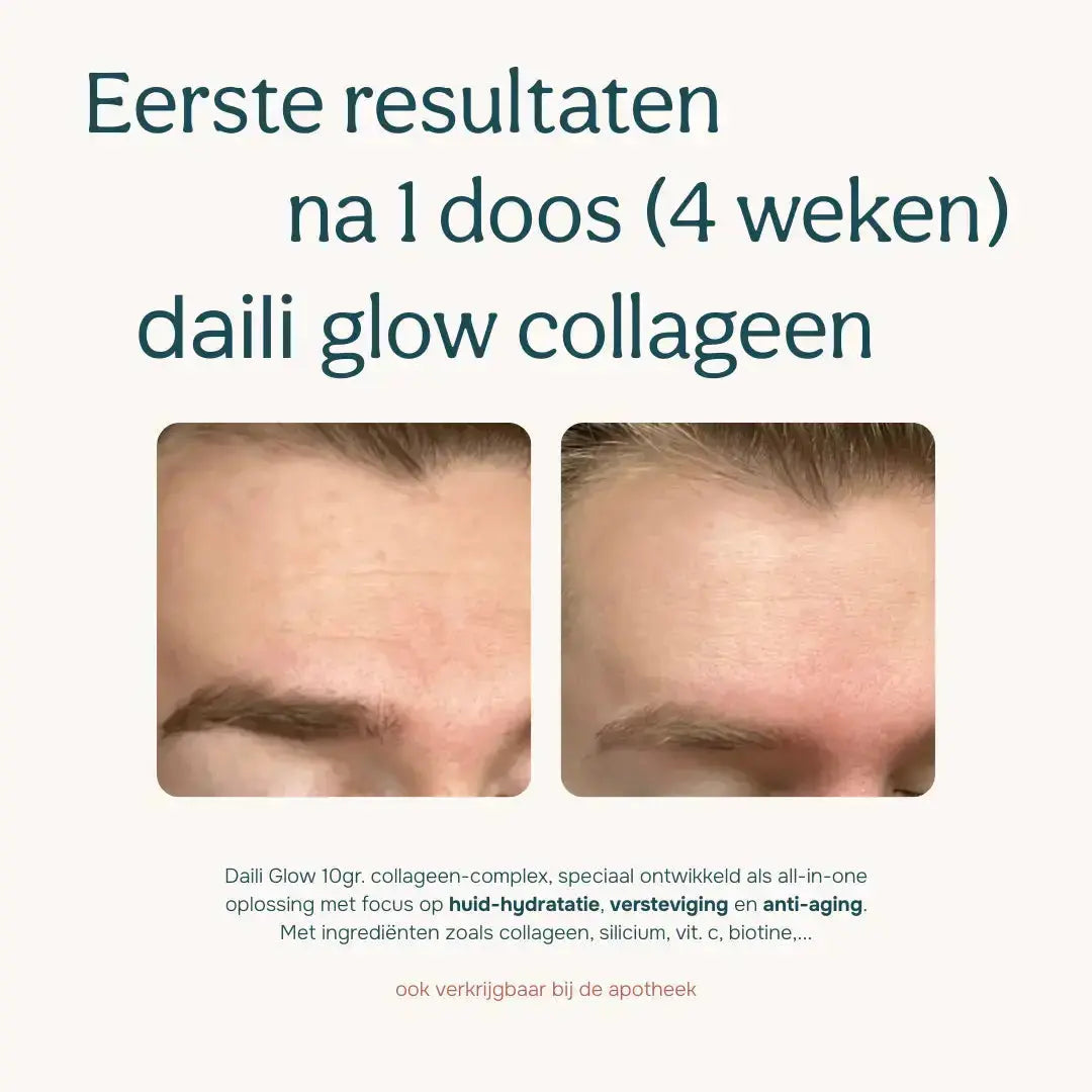 Daili Glow collageen voor en na 4 weken resultaat vermindering rimpels voorhoofd huidhydratatie anti-aging